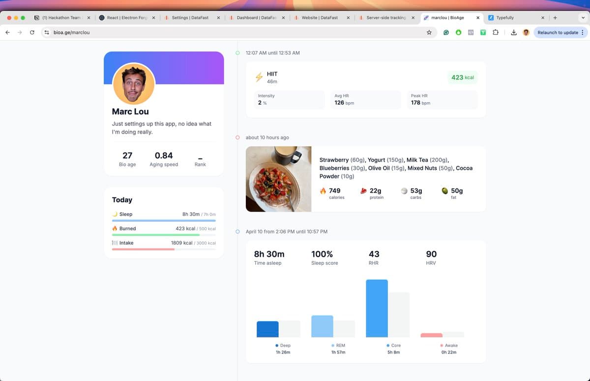 All my health data is now public at bioa.ge/marclou 😴 Sleep pulled from wearable 💦 Exercises pulled from wearable 🥦…